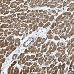 Carbohydrate Sulfotransferase 15/CHST15 Antibody, Novus Biologicals:Antibodies:Primary
